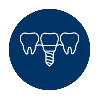 Icon of a dental implant, depicting a simplified graphic of a screw-like implant, abutment, and a crown resembling a natural tooth.